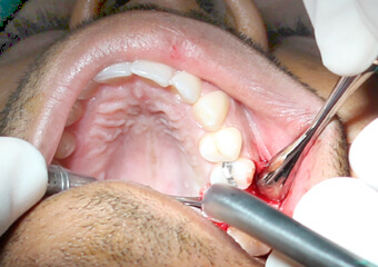 DPU Dental Implant Centre
