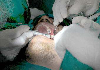 DPU Dental Implant Centre