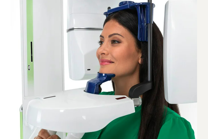 CBCT
